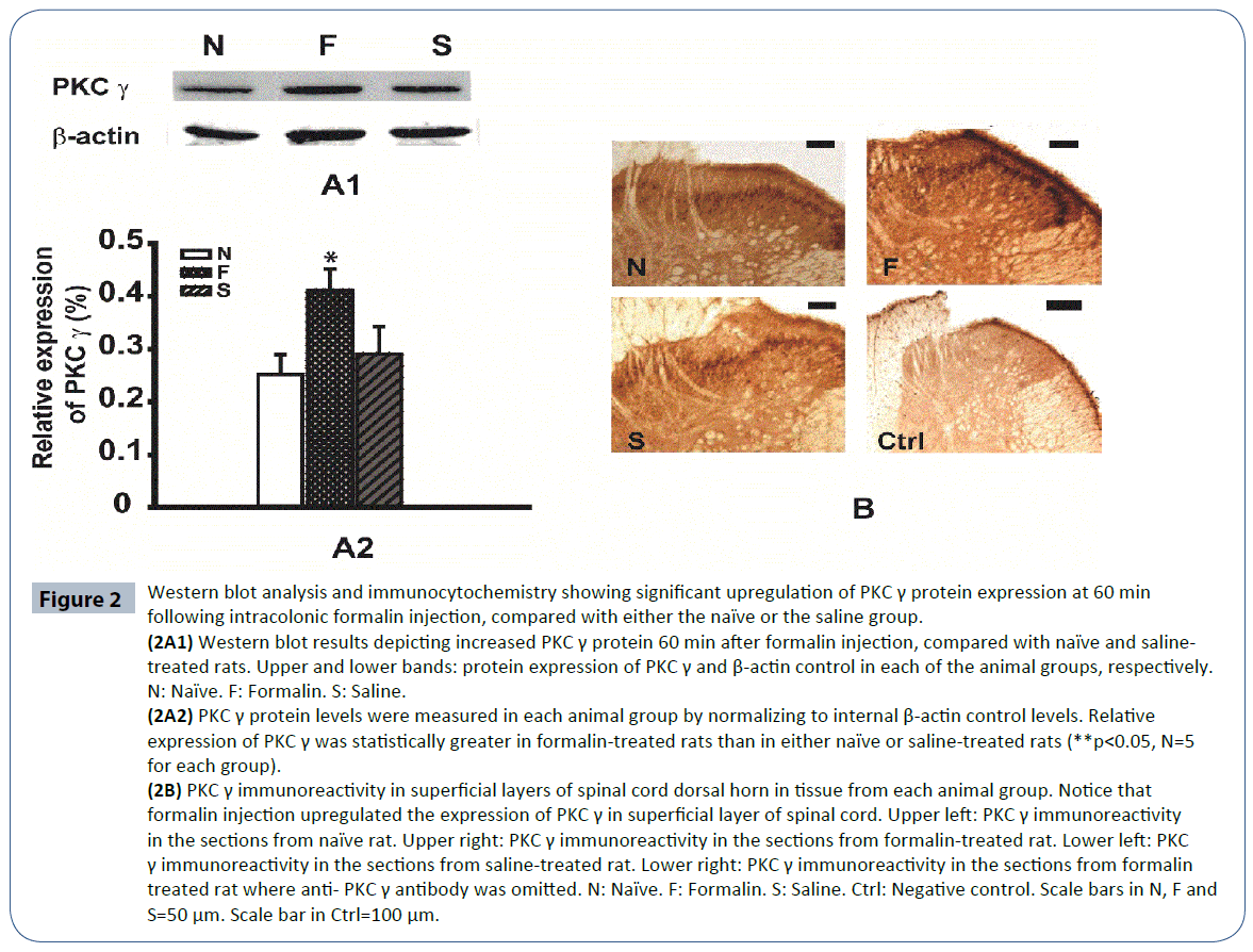 headache-Western-blot-analysis