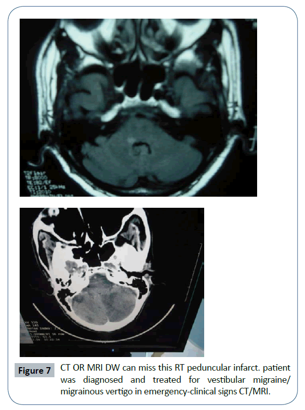 headache-pain-management-emergency-clinical