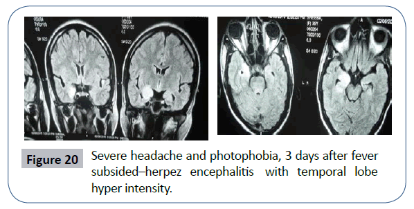 headache-pain-management-hyper-intensity