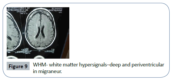 headache-pain-management-matter-hypersignals