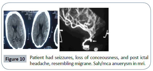 headache-pain-management-post-ictal